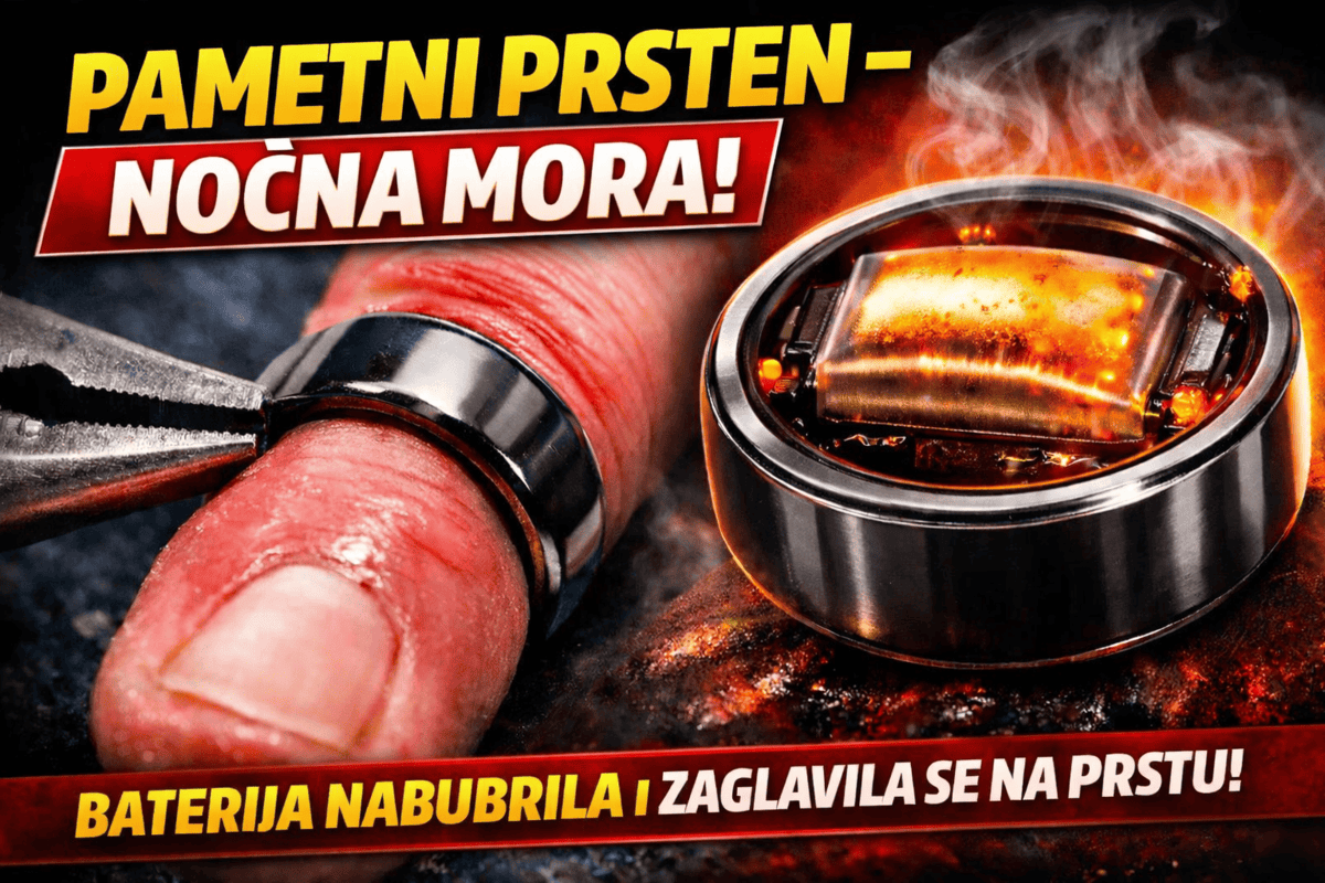 Pametni prsten koji se pretvorio u noćnu moru: Galaxy Ring natekao korisniku na prstu